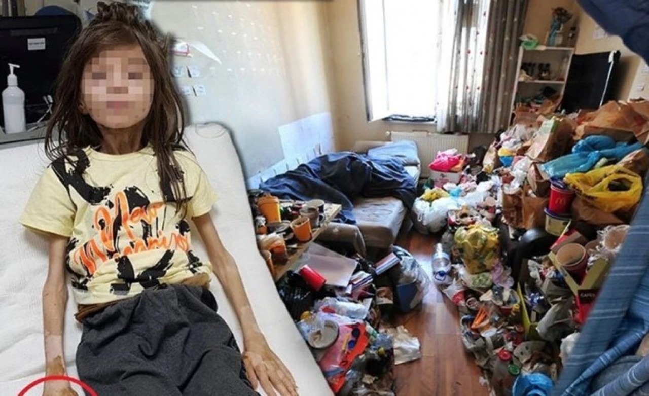 Teyzesi tarafından alıkonulmuştu: Çöp evde bulunan 10 yaşındaki çocuğun son hali yüzleri güldürüyor