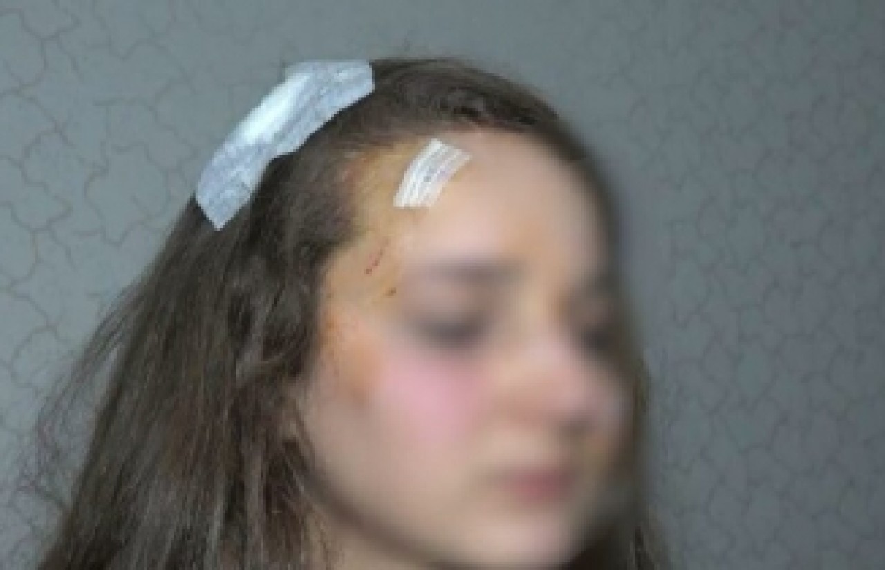 Muşta ile genç kızı acımazsızca darp etti: 'Abimi öldüren kıza benzettim' dedi