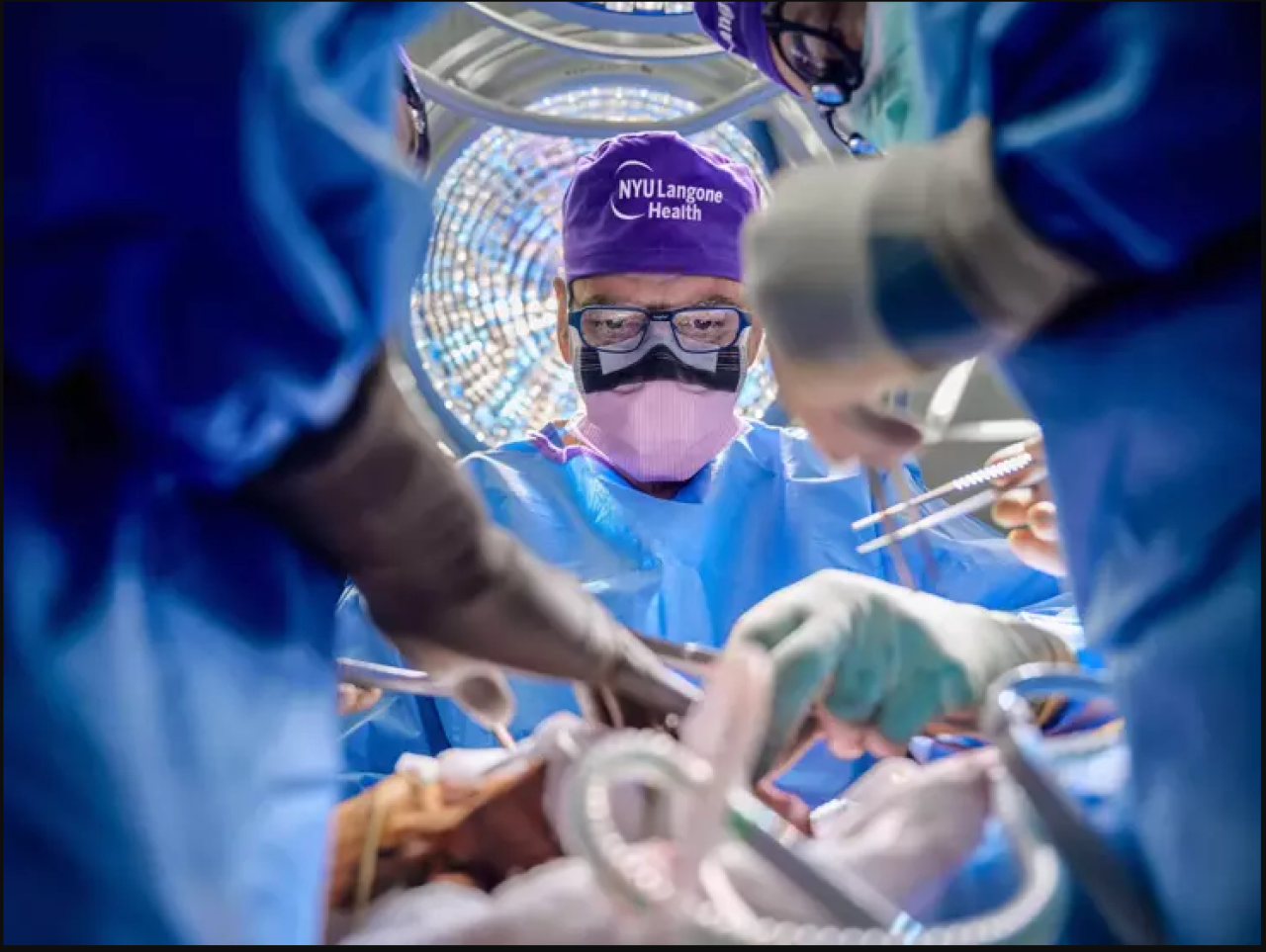 Dünyada ilk: ‘Tam göz’ nakli yapıldı!