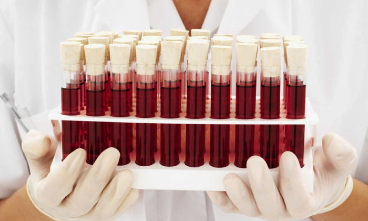 Bilim dünyası son noktayı koydu: İşte en zeki insanların kan grubu!