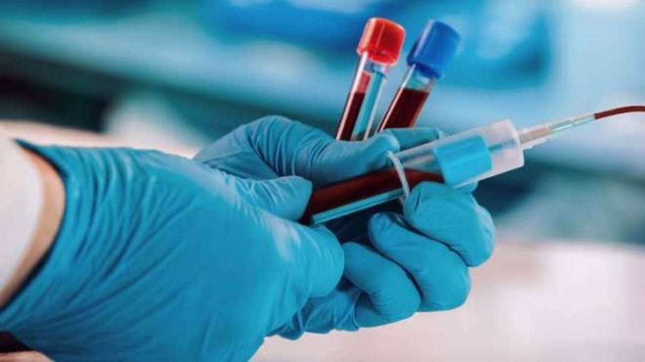 Kan grubuna göre ne kadar zekisin? İşte en yükse IQ'ya sahip kan grubu...