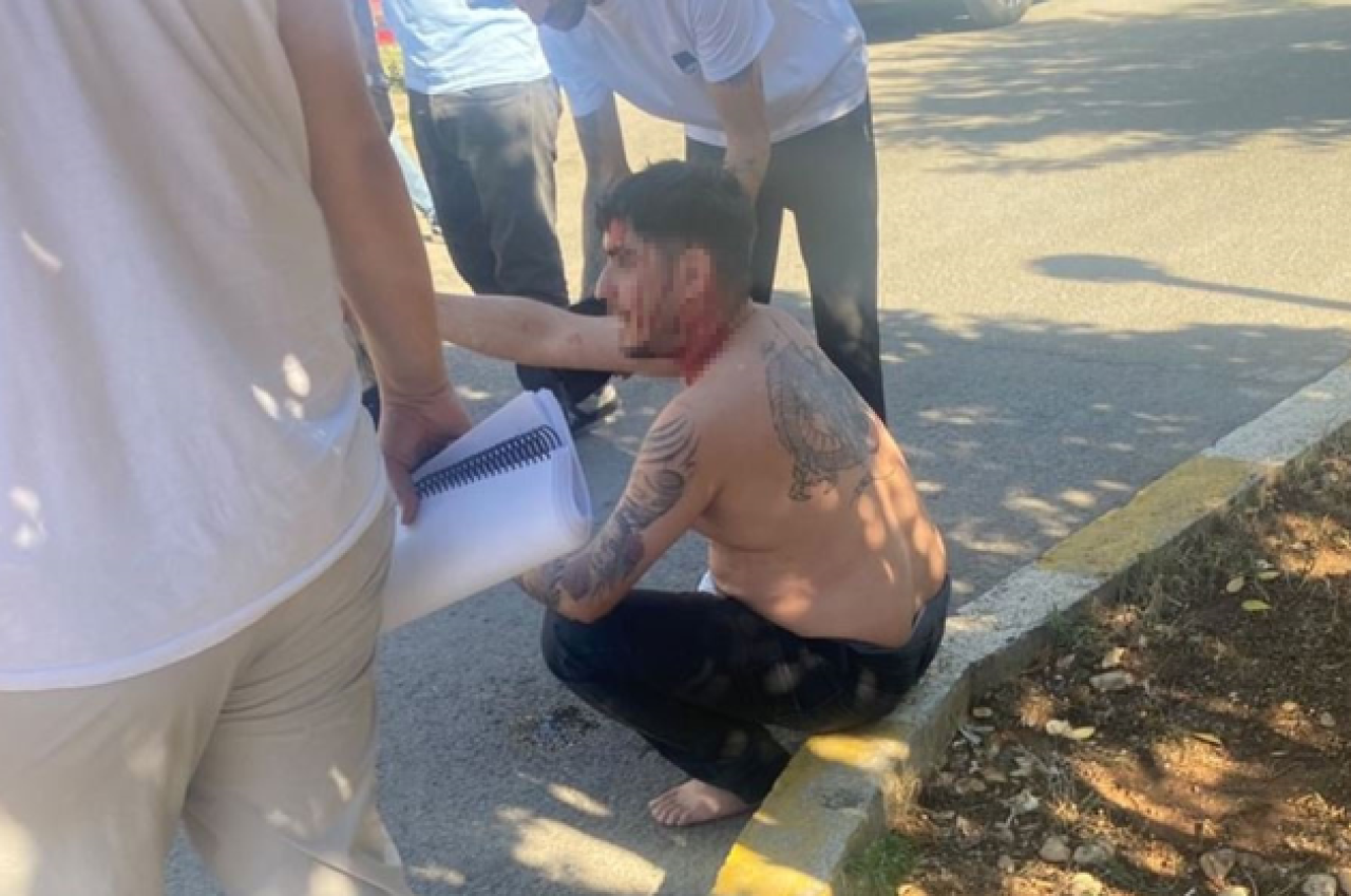 Dizi setine silahlı saldırı! Cengo rolüyle tanınan oyuncu  başından yaralandı