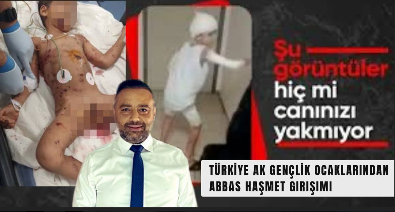 Türkiye’de Başıboş Köpek Sorunu: Abbas Haşmet Yoğun Bakımda