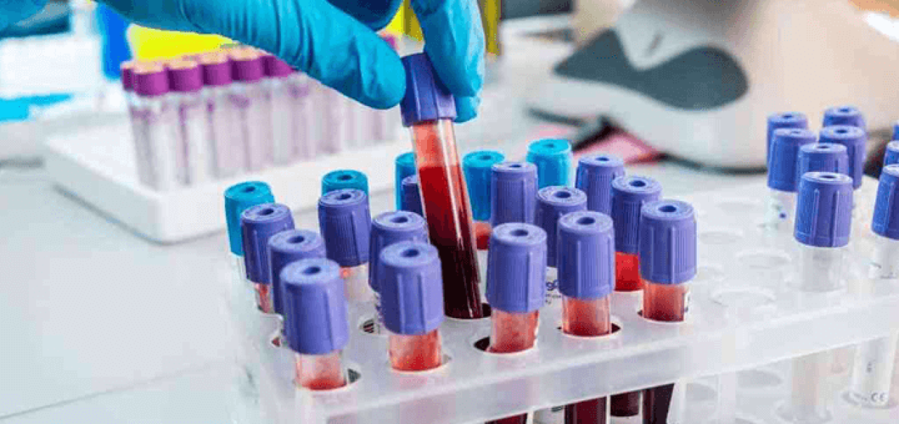 Bilim dünyası son noktayı koydu! İşte en zeki insanların kan grubu