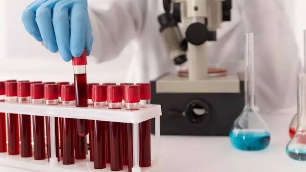 En düşük zekaya sahip kan grubu belli oldu!