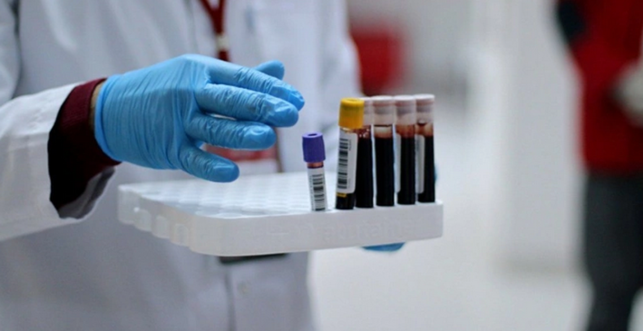 Bu kan grubundan olanlar dikkat! Bunamaya daha yatkın oluyorlar