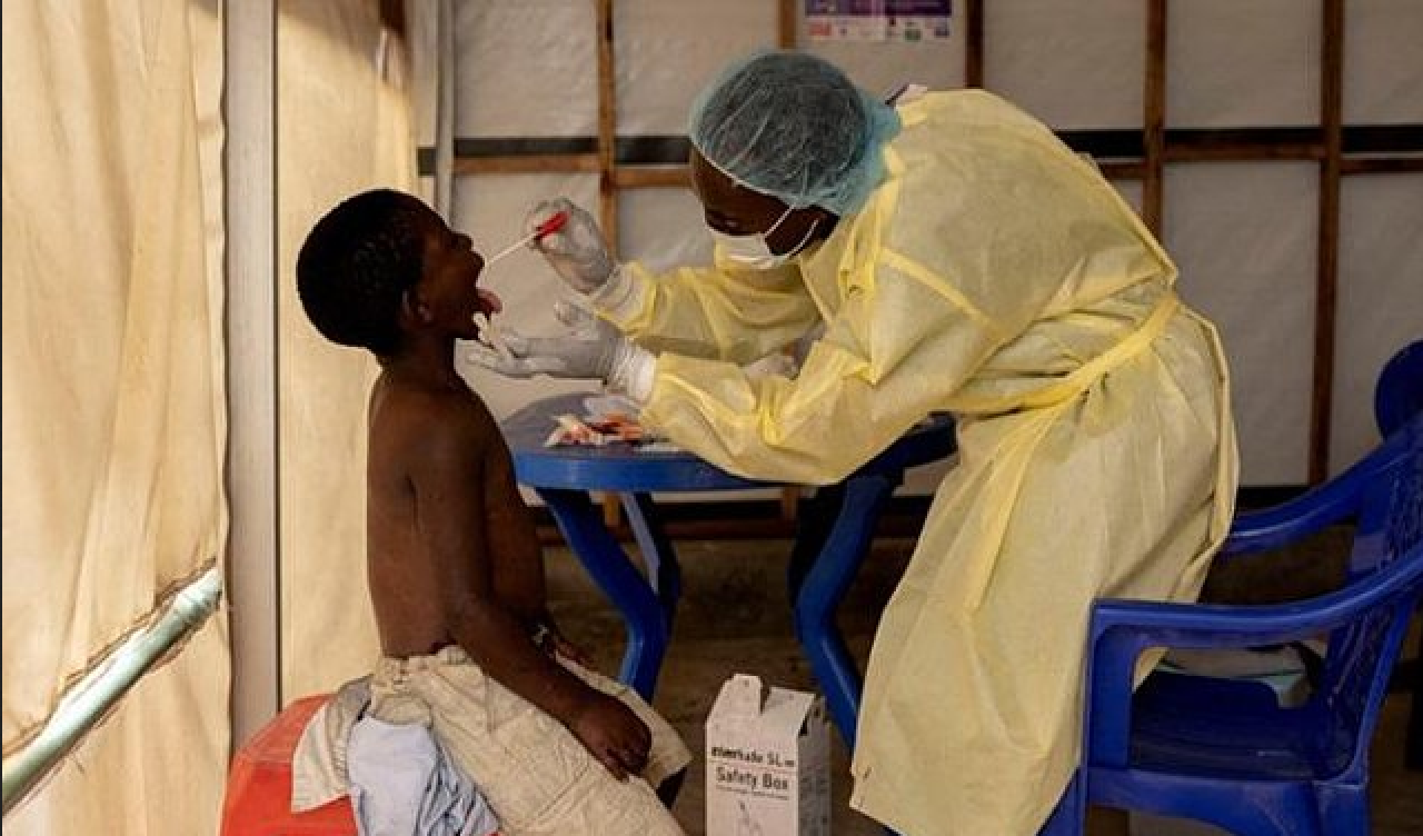 Afrika Birliği M çiçeği salgınına karşı kıta genelinde acil durum ilan etti!