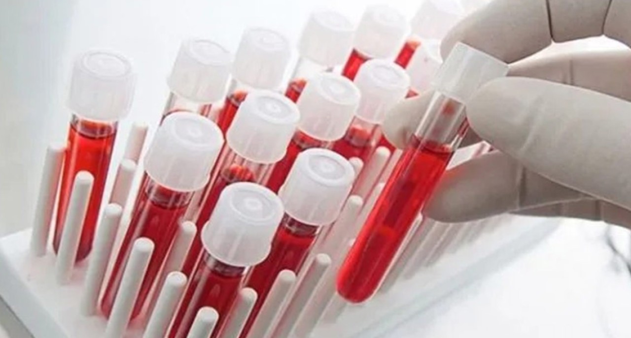 Felç riski en yüksek kan grubu belli oldu