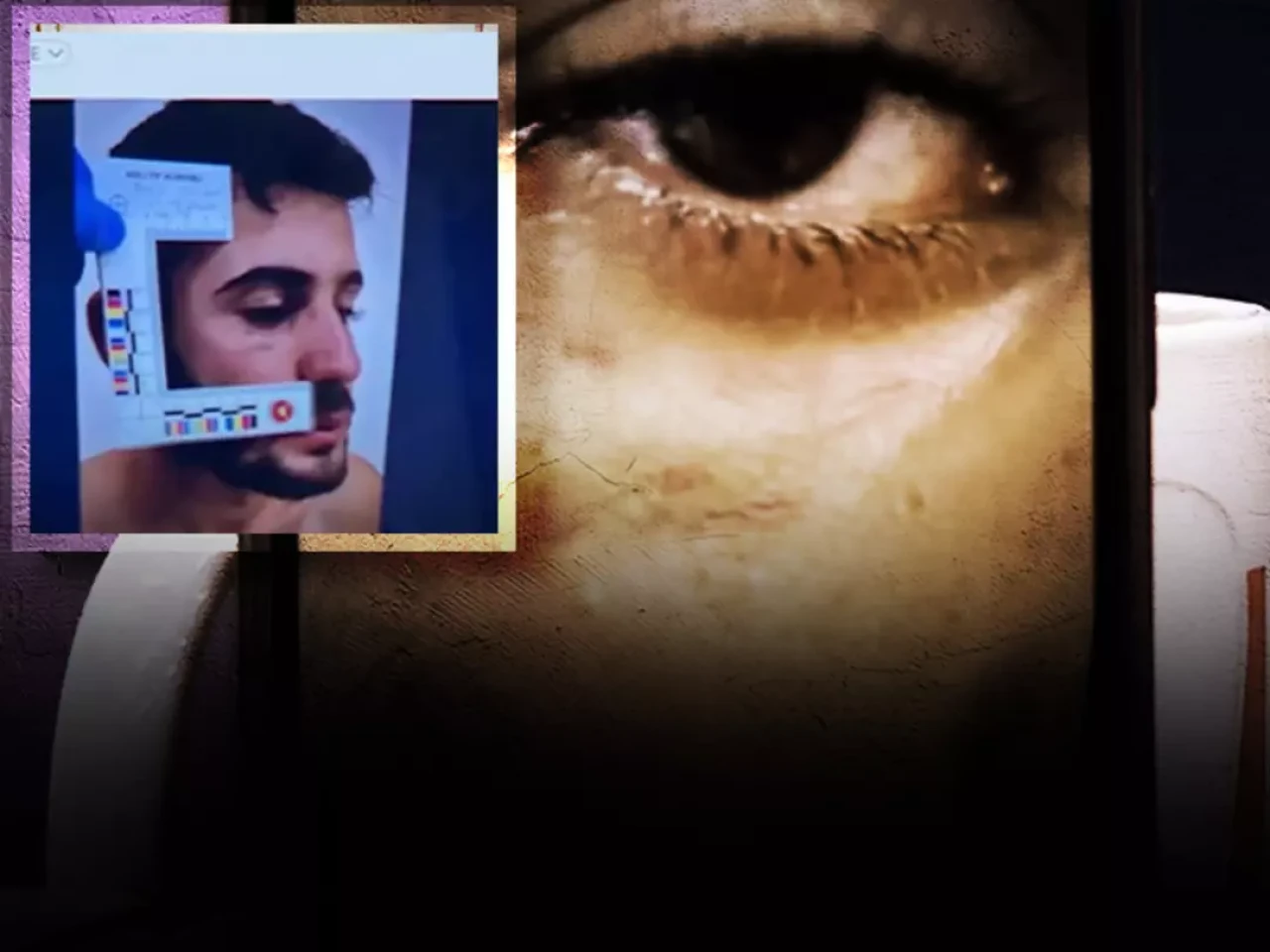 Soruşturmanın seyrini değiştirecek gelişme: Ağabey Enes Güran'ın yüzündeki morluk ve ısırık izleri...