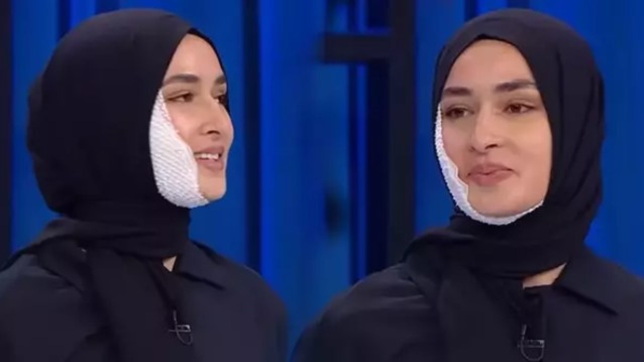 Yüzü yanan MasterChef Beyza sargısını çıkardı,  her şey kurgu muydu?