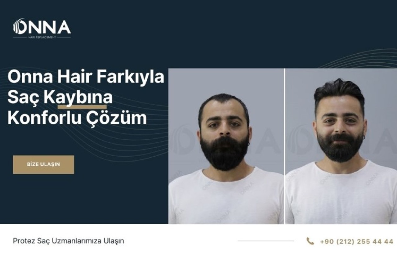 Onna Hair Güvencesiyle Saçlarınıza Yeniden Ulaşın!