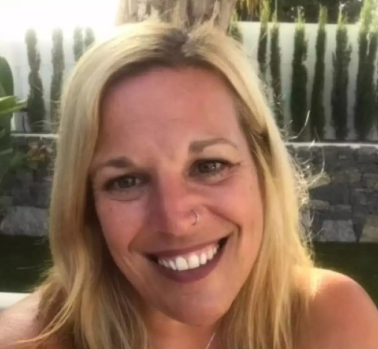 Grip olduğunu zannetti 6 hafta komada kaldı! Uyandığında bacakları kesilmişti