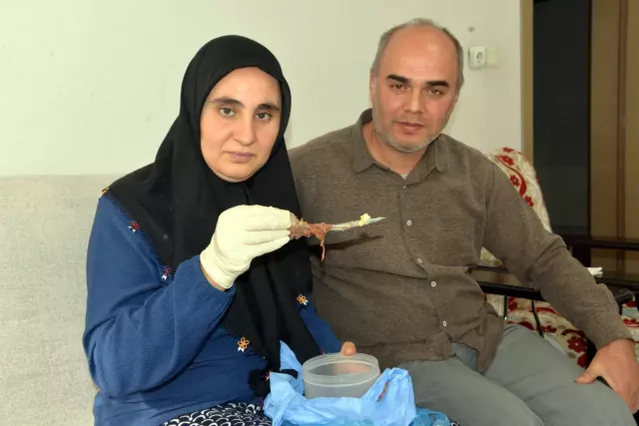 Şok eden olay: Baş ağrısıyla gitti,  karnından 16 cm makas çıktı