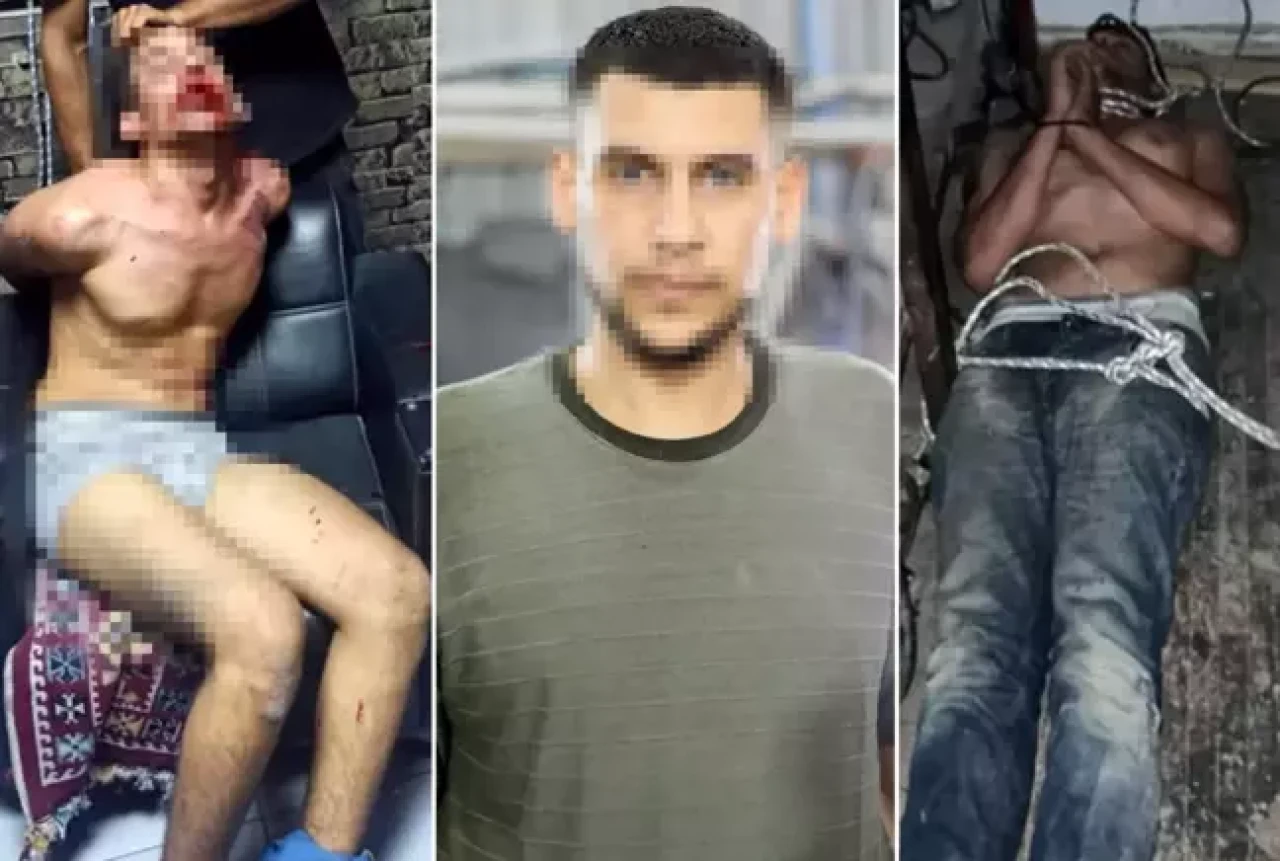 3 gün boyunca işkence edilen şahıs ilk kez konuştu