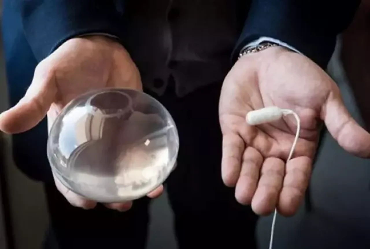 Sağlık Bakanlığı’ndan mide balonu sistemi için tedbir kararı!