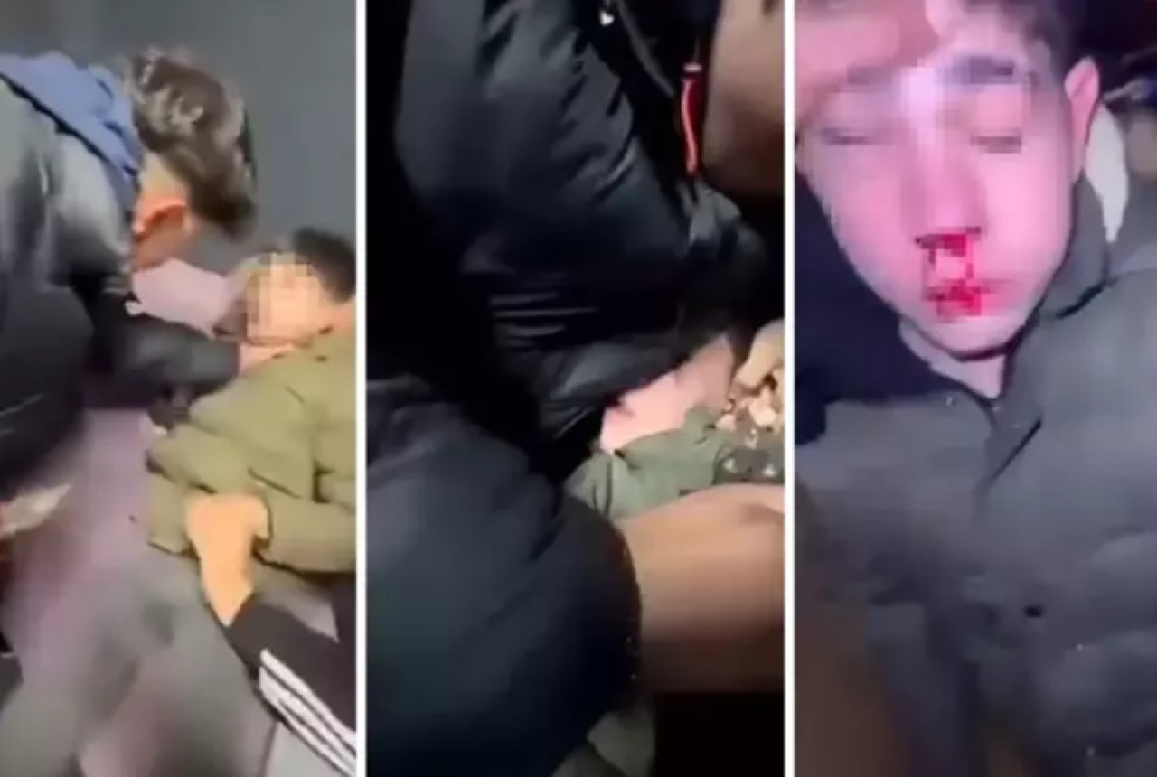 Sağır ve dilsiz çocuğa işkence! Dövüp kulağını kestiler..