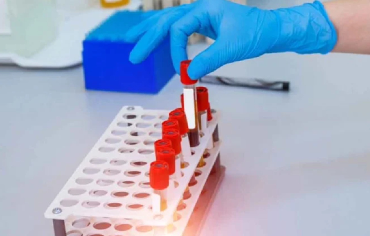 Bu kan grubuna sahip insanların ciltleri kırışmıyor