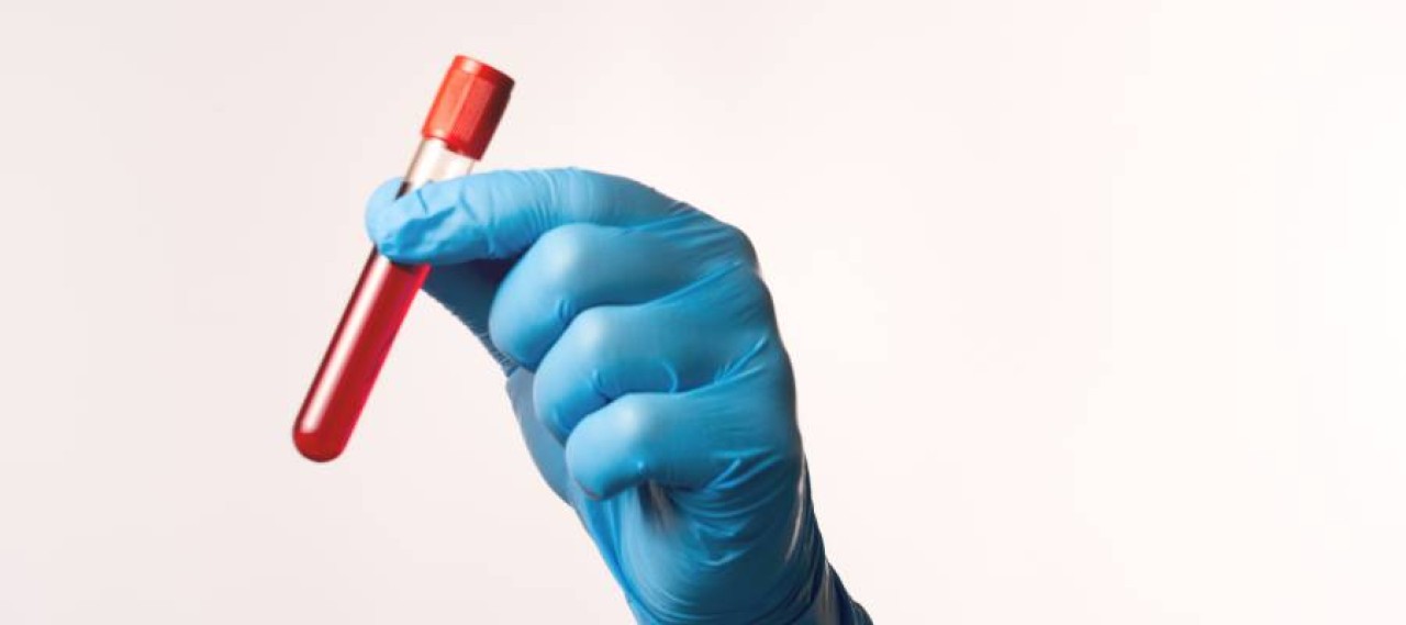 EOS (Eozinofil) Nedir? İnsan Sağlığındaki Rolü ve Önemi