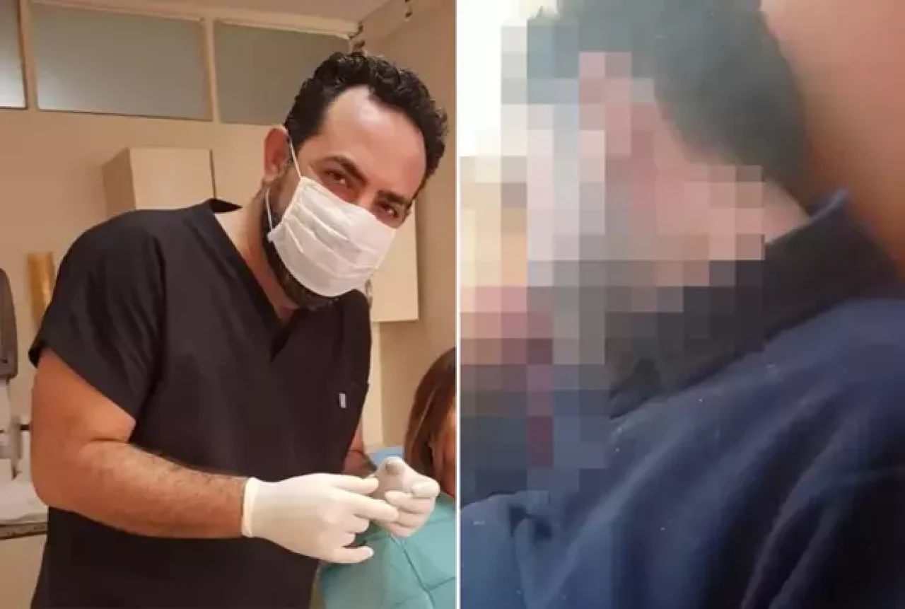 Diş hekimini başından vurdu,  can çekiştiği anları annesine gönderdi