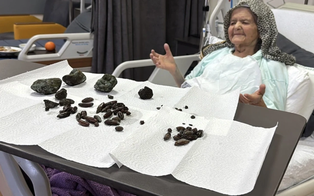 Yuttuğu zeytin ve hurma çekirdekleri başına iş açtı!