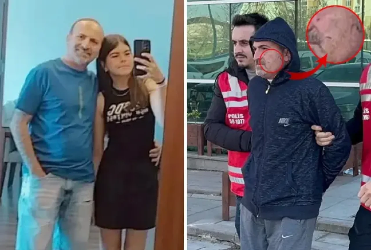 Kızını öld.ren babanın yüzündeki tırnak izleri yürekleri dağladı