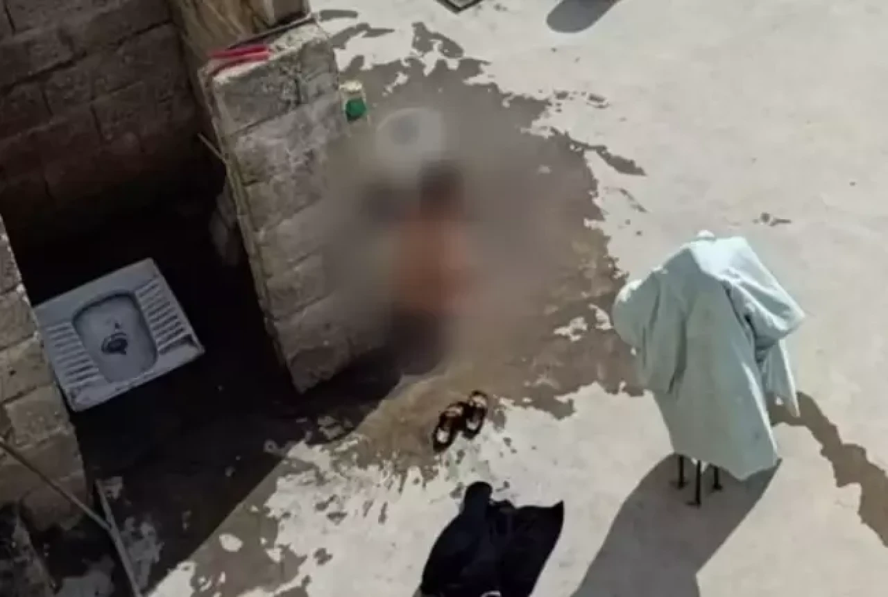 Çocuklara işkence eden Baba ve üvey anne gözaltına alındı!