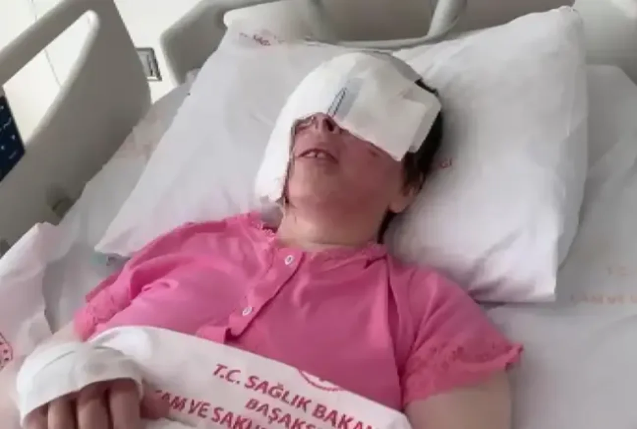 Avcılar'da dehşet: Kezzap saldırısına uğrayan kadın görme yetisini kaybetti!