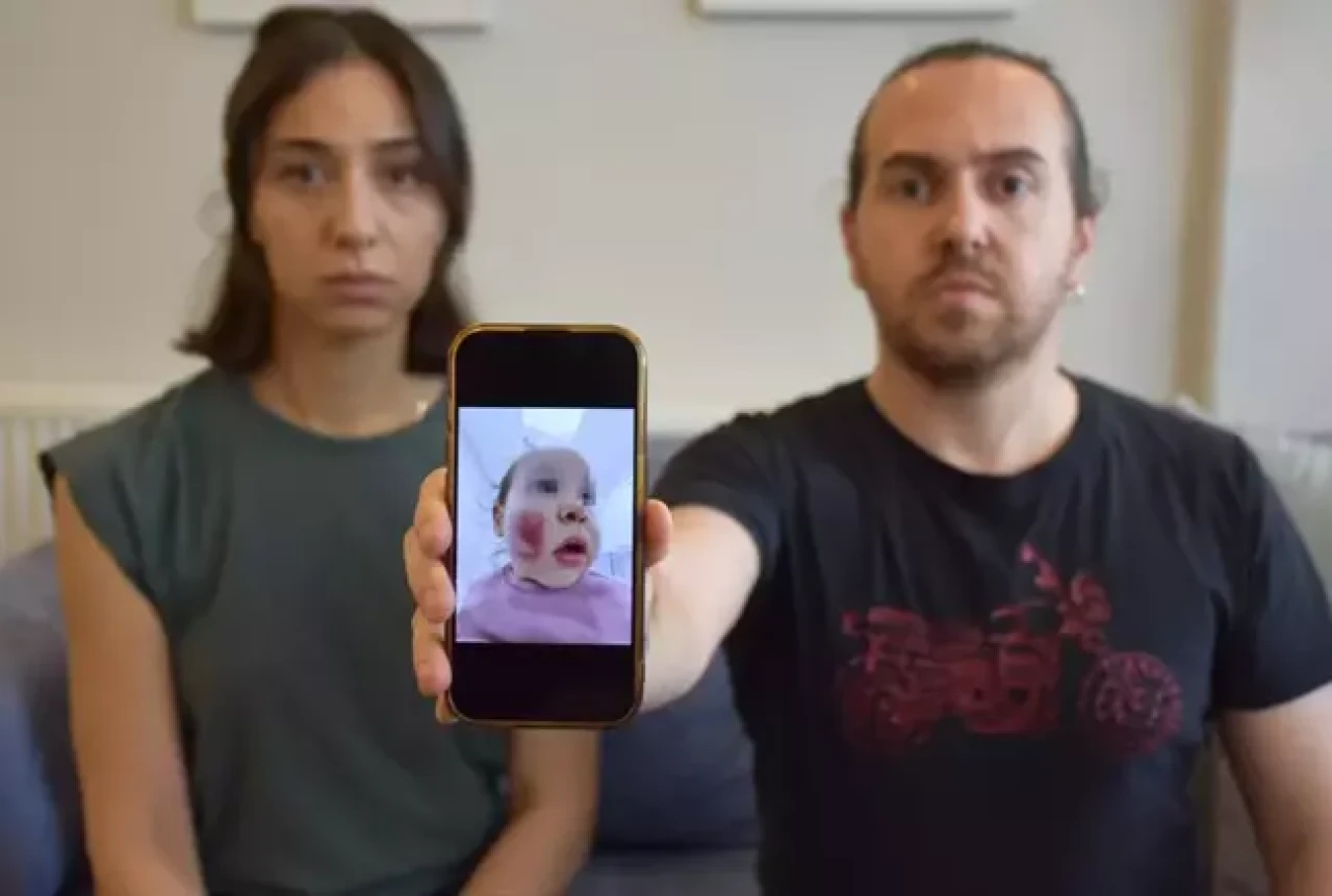 2 yaşındaki bebeğe kreşte dayak,  yüzü parçalanmış!