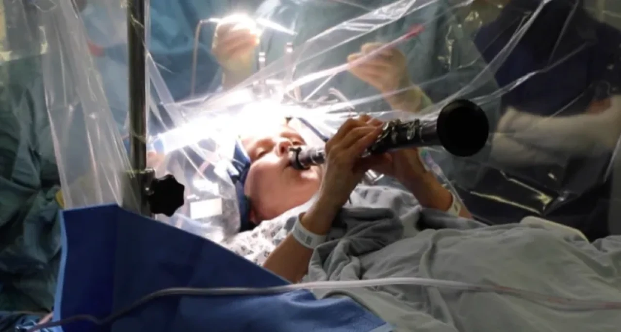 Beyin ameliyatında klarnet elinden düşmedi!