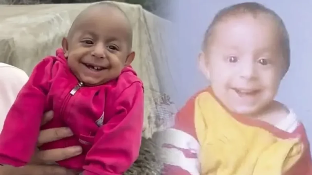 Sosyal medyada 'Gülen Bebek' olarak tanınan Ökkeş bebek yaşamını yitirdi