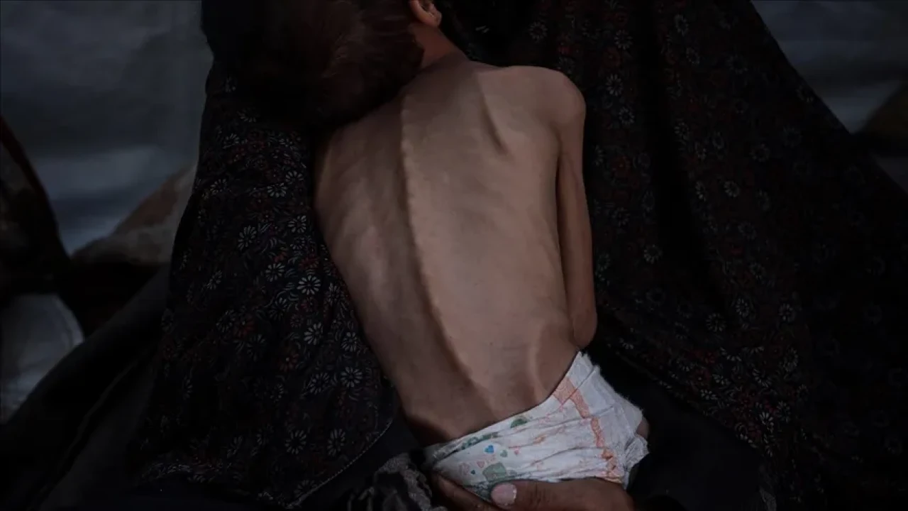 Gazze’de açlık krizi derinleşiyor: Can kaybı 455’e çıktı