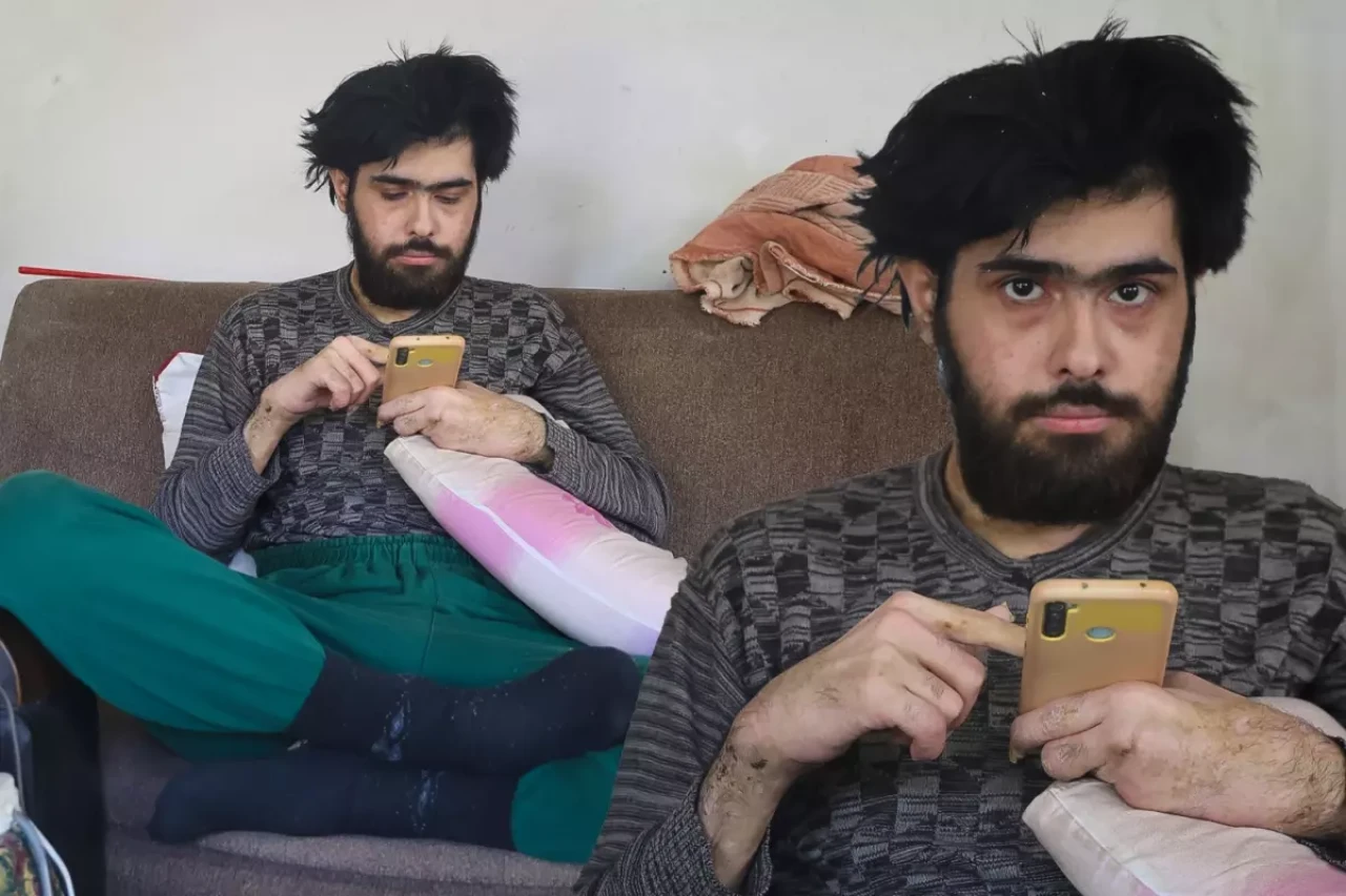 3 yıldır tırnaklarını kesmeyen ve duş almayan gencin eski hali ortaya çıktı