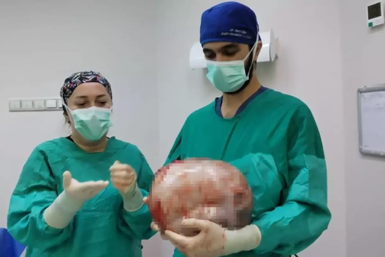 2 ayda karnı 9 aylık hamile gibi büyüyen kadından bakın ne çıktı!