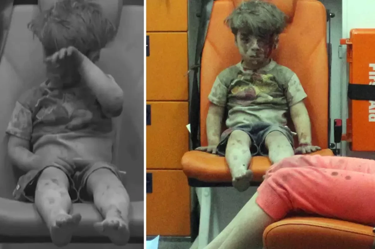 Dünya gündemine oturan Ümran bebeğin son hali.. Yürekleri burktu