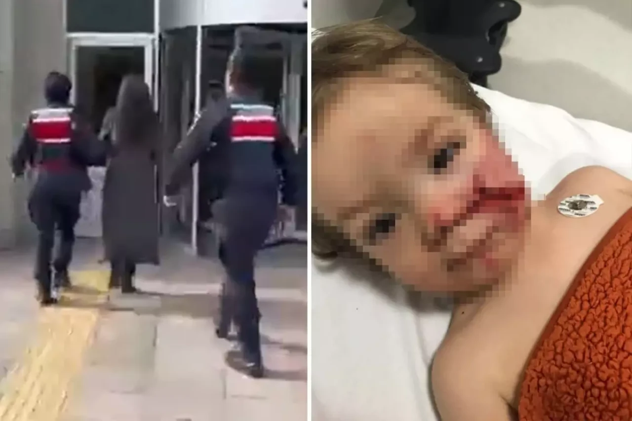 Ankara’da iki küçük kardeşe saldıran pitbull ve sahibi tutuklandı