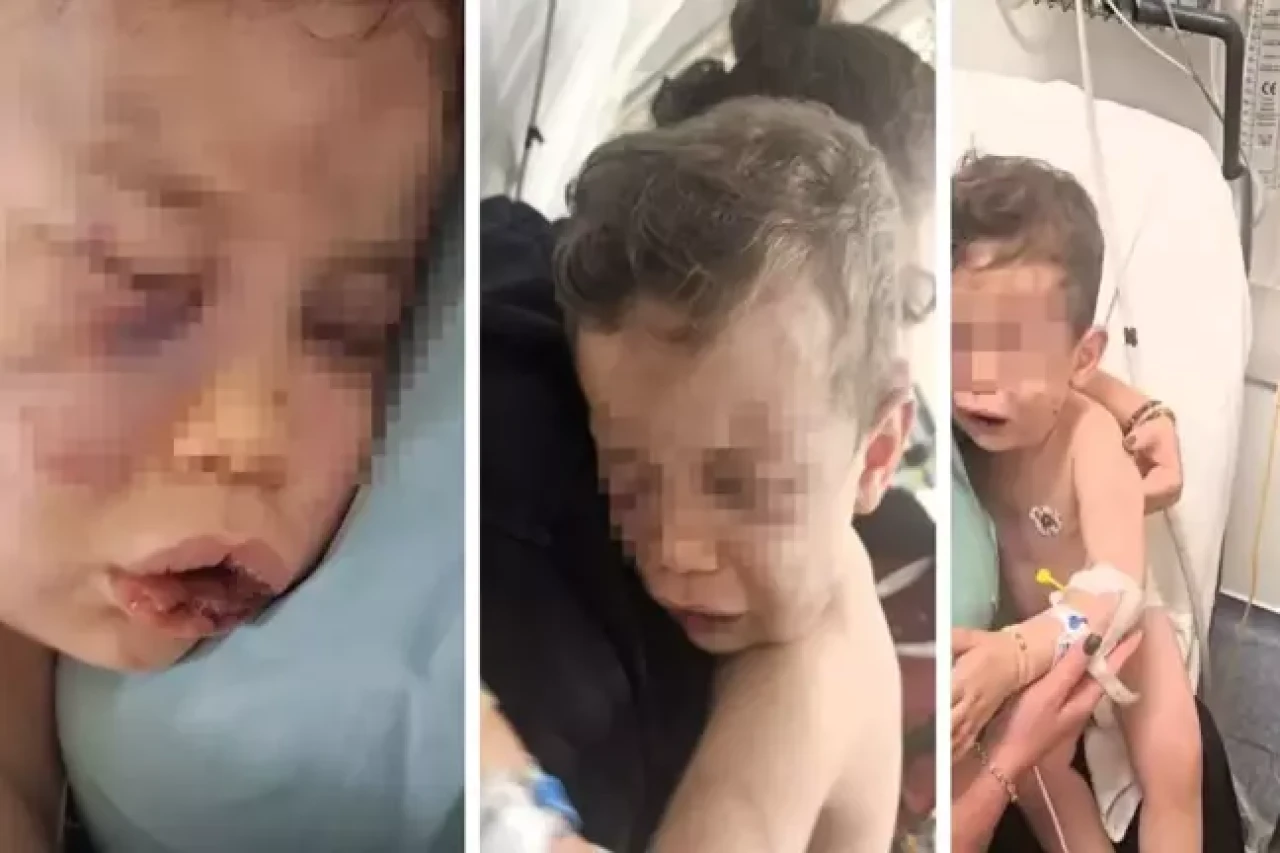 2 yaşındaki bebek annesinin sevgilisi tarafından öldüresiye dövüldü