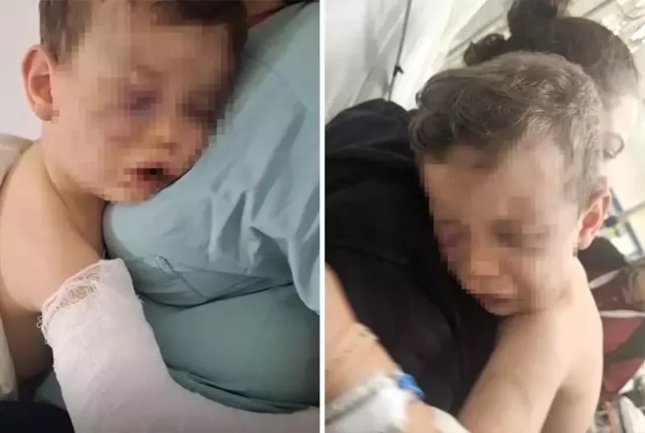 Annesinin sevgilisinin öldüresiye darbettiği Aren bebeği yakmaya çalışmışlar