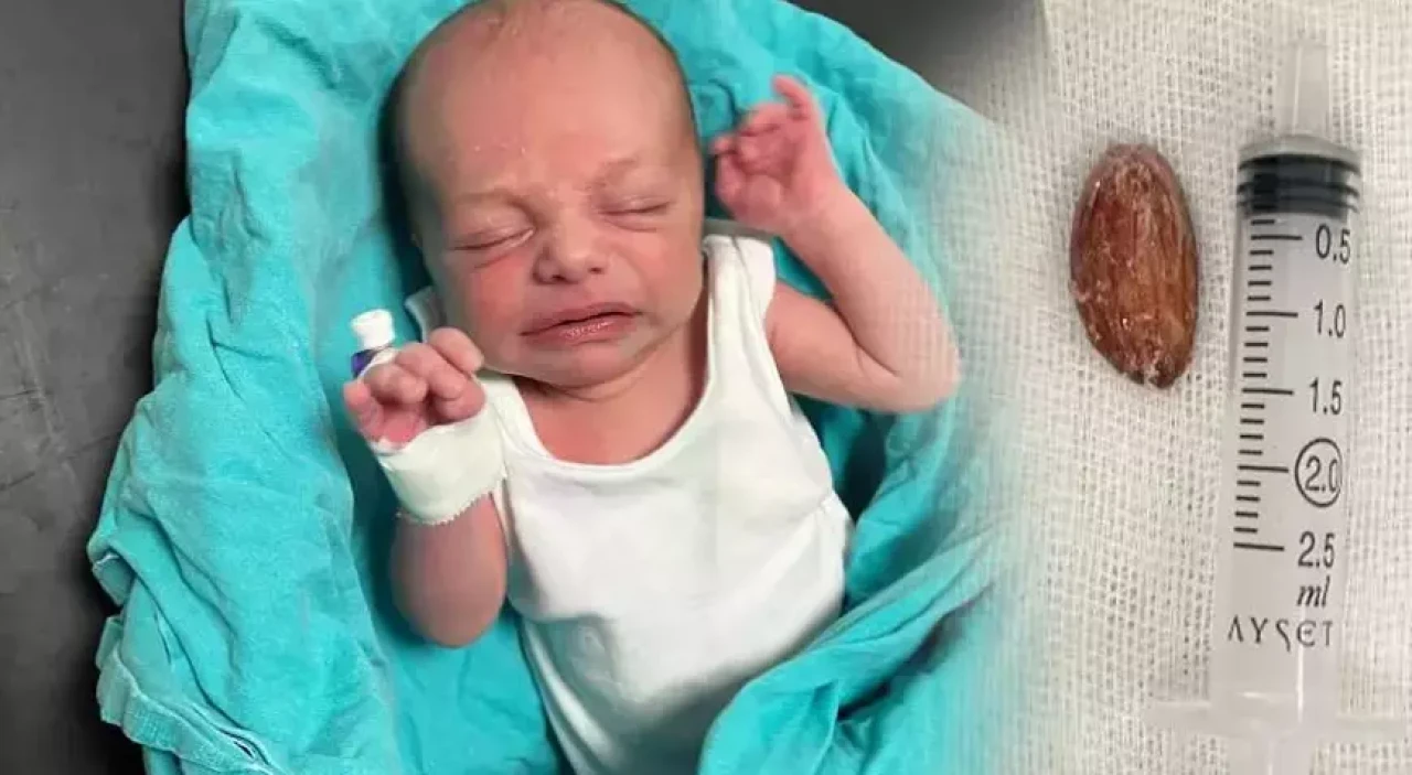16 günlük Muhammed bebeğin yemek borusundaki şeker çıkarıldı