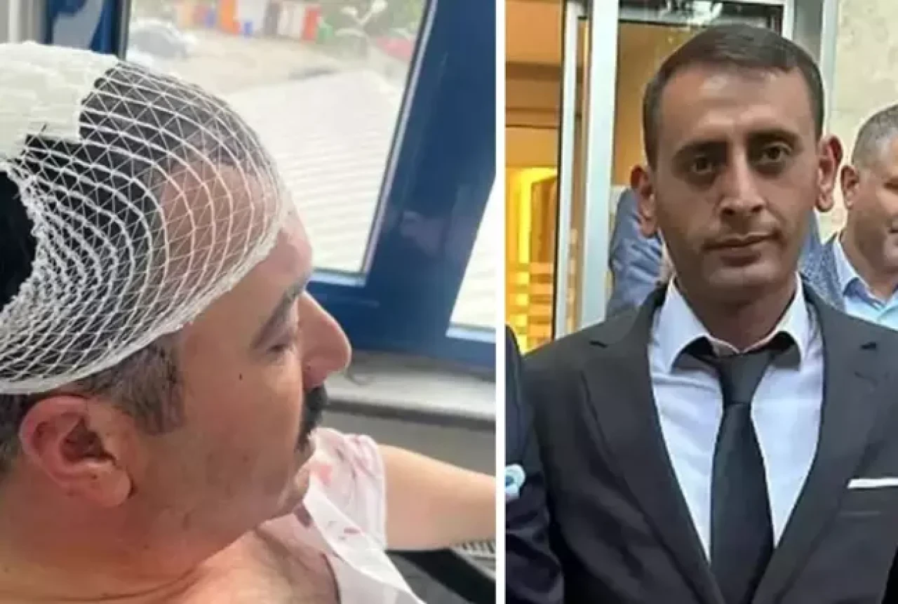 Belediye Başkan Yardımcısı'na şekerlikle saldıran Yeniden Refah Partili tutuklandı