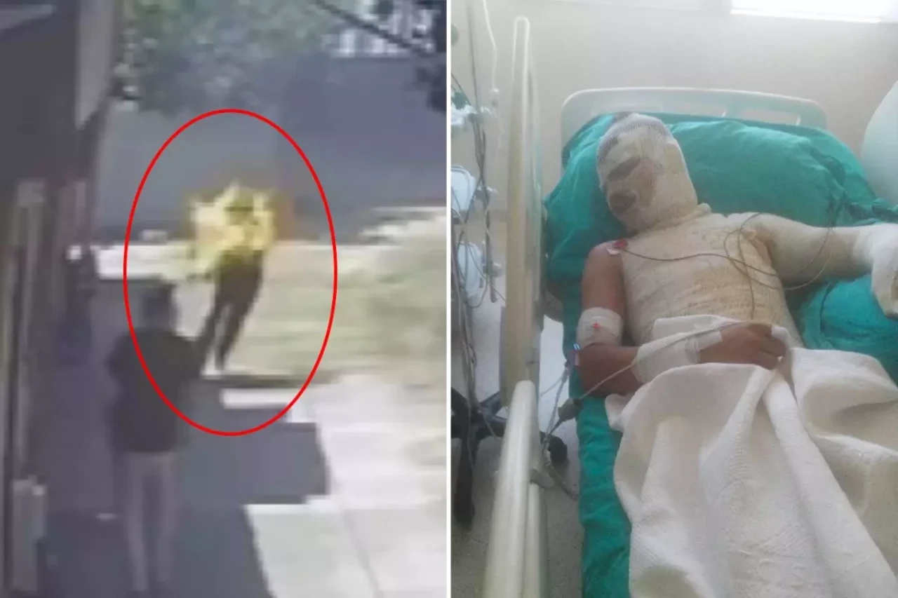 Yeğenini diri diri böyle yaktı