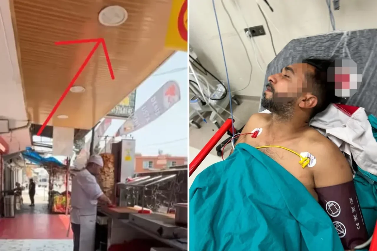 Adana’da dürüm yerken başına kurşun isabet etti!