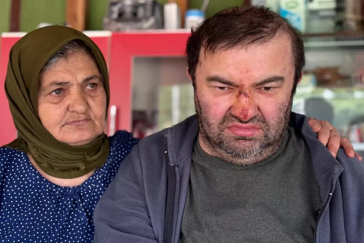 Bolu’da yürek burkan olay: Engelli Murat Kepil akrabası tarafından darp edildi!