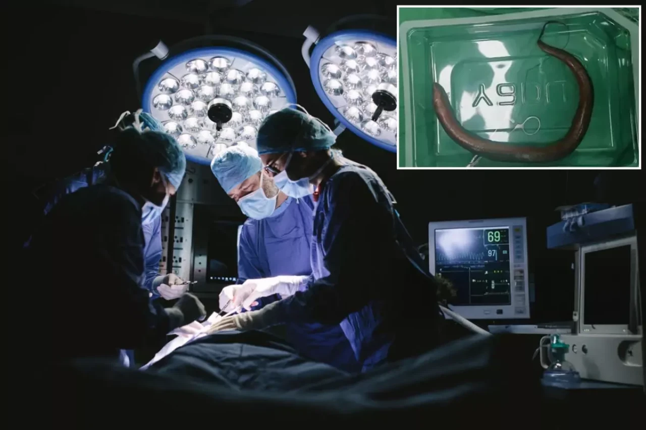 Karın ağrısı şikayetiyle hastaneye giden adamın karnından canlı yılan balığı çıktı