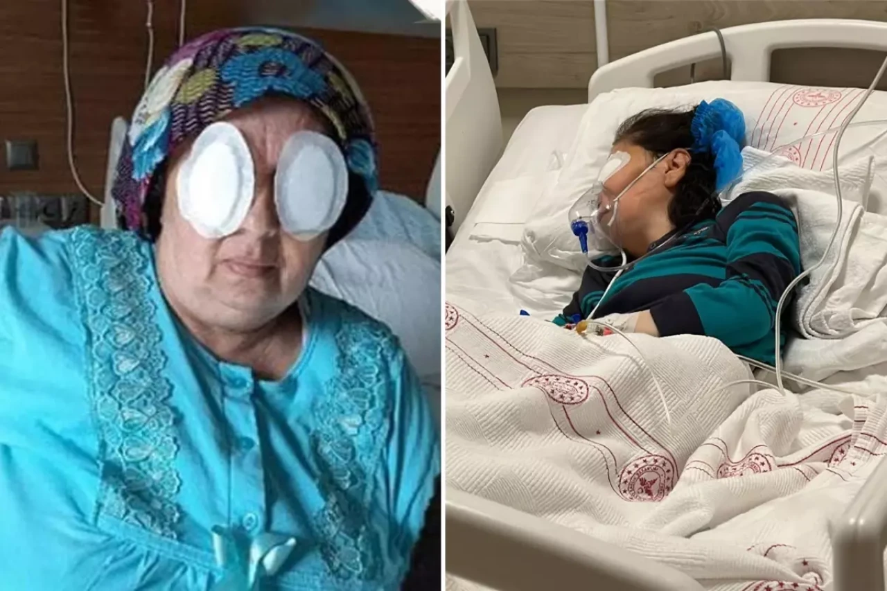 Şizofreni hastası, yatalak hastanın gözlerini oydu! İlk vukuatı değil