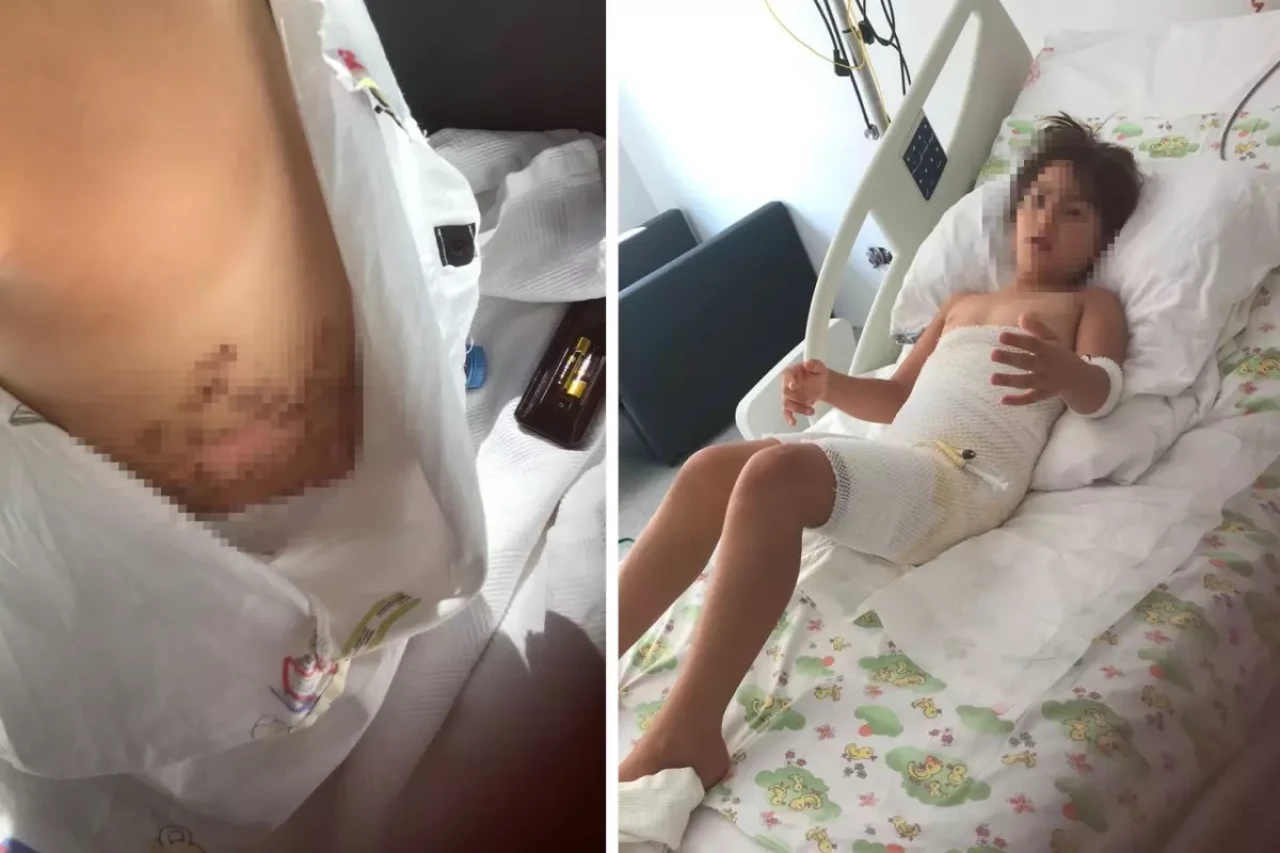 Gittikleri düğün felaketi oldu! Vücudunun yüzde 16'sı dondu