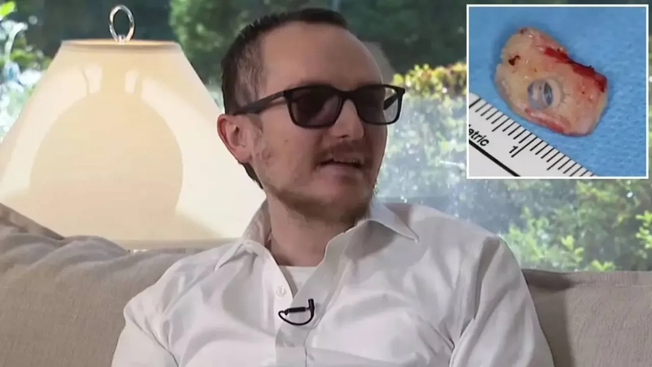 20 yıllık körlüğe son! Kendi dişi gözüne takıldı, görmeye başladı