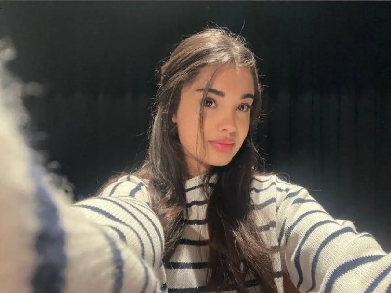 Çarpıntı Lizgi Cömert estetiksiz hali! Eski görünümü nasıl?