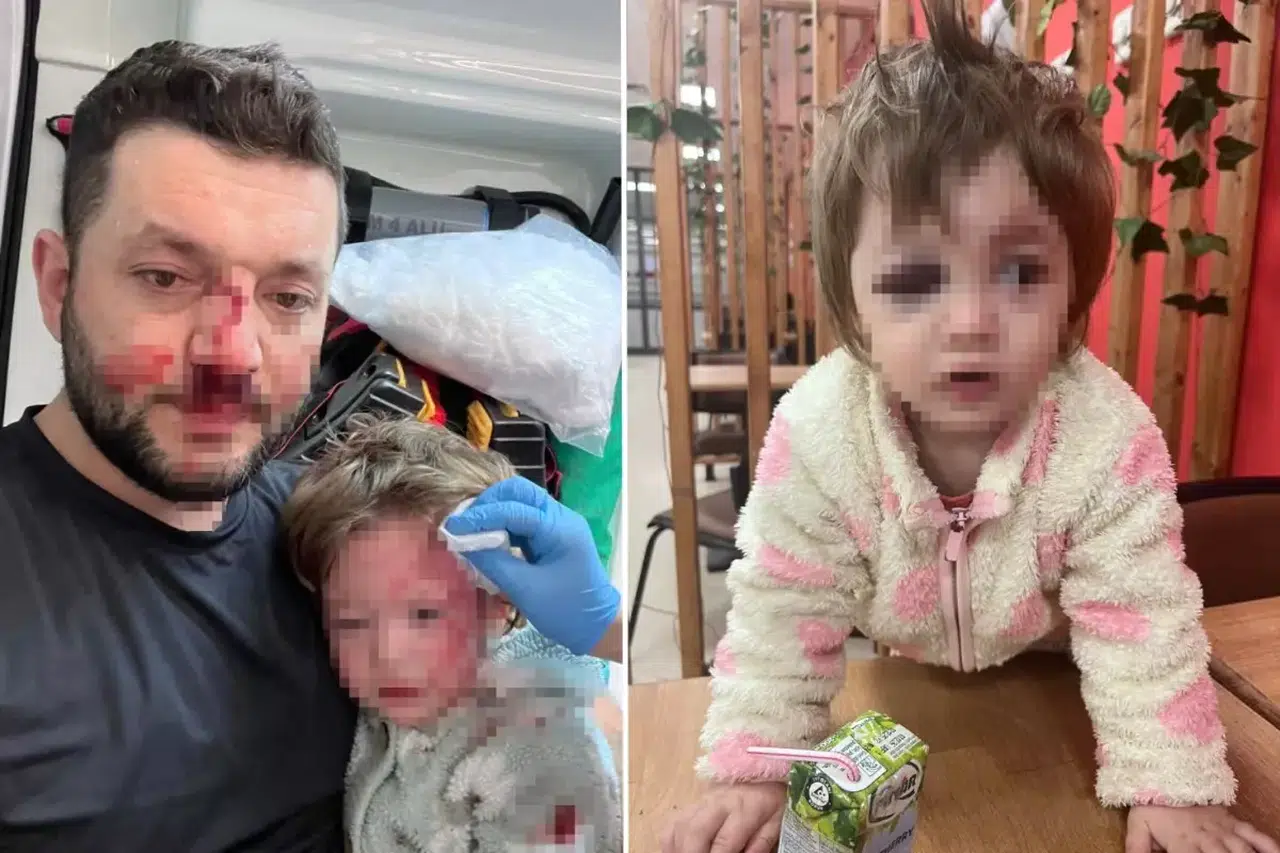 Komşu kavgası faciaya dönüştü: 14 aylık bebek ağır yaralandı