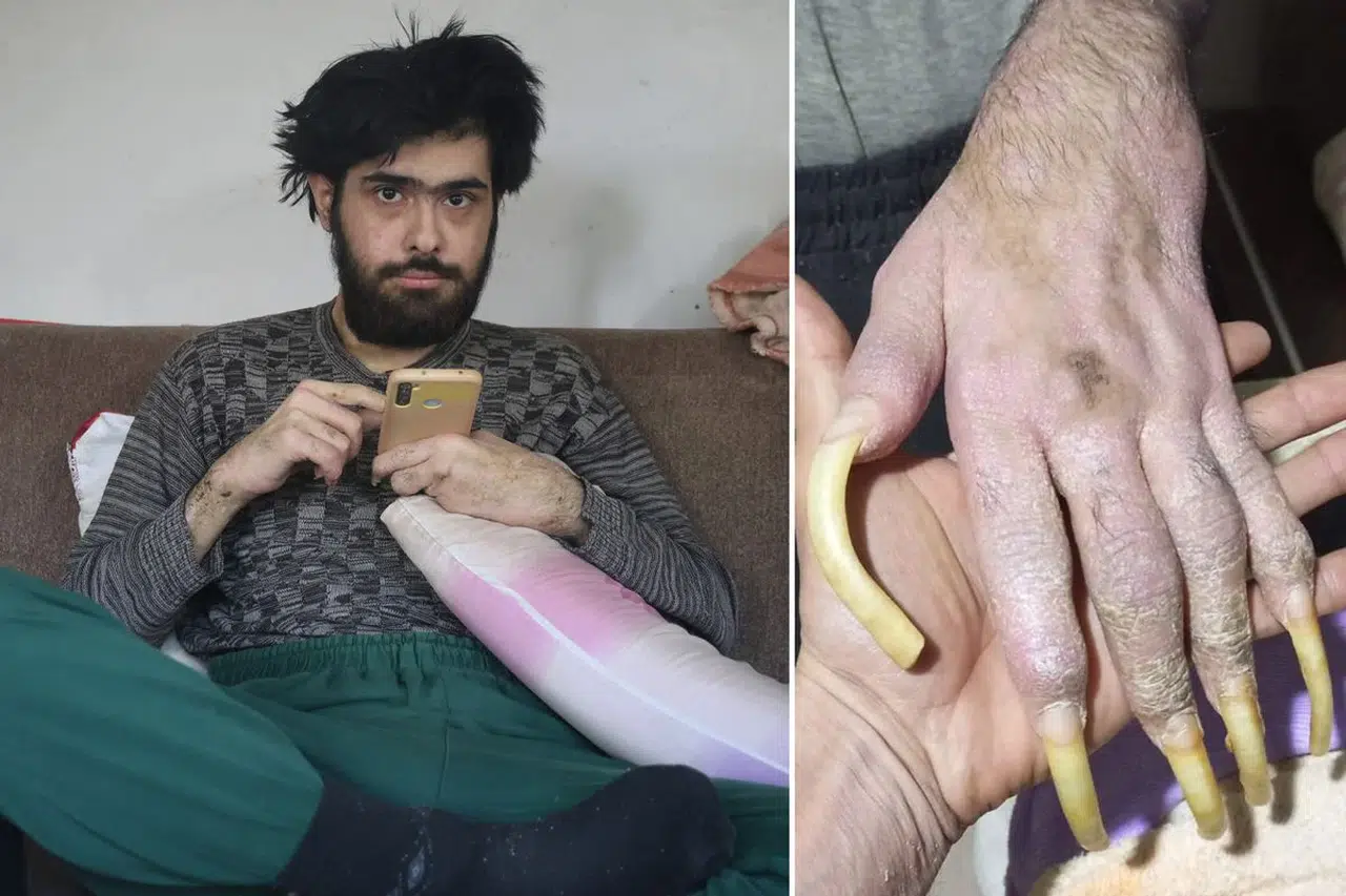 Türkiye’nin gündemindeki Barış’tan dikkat çeken anlar! Doğum gününde türkü söyledi