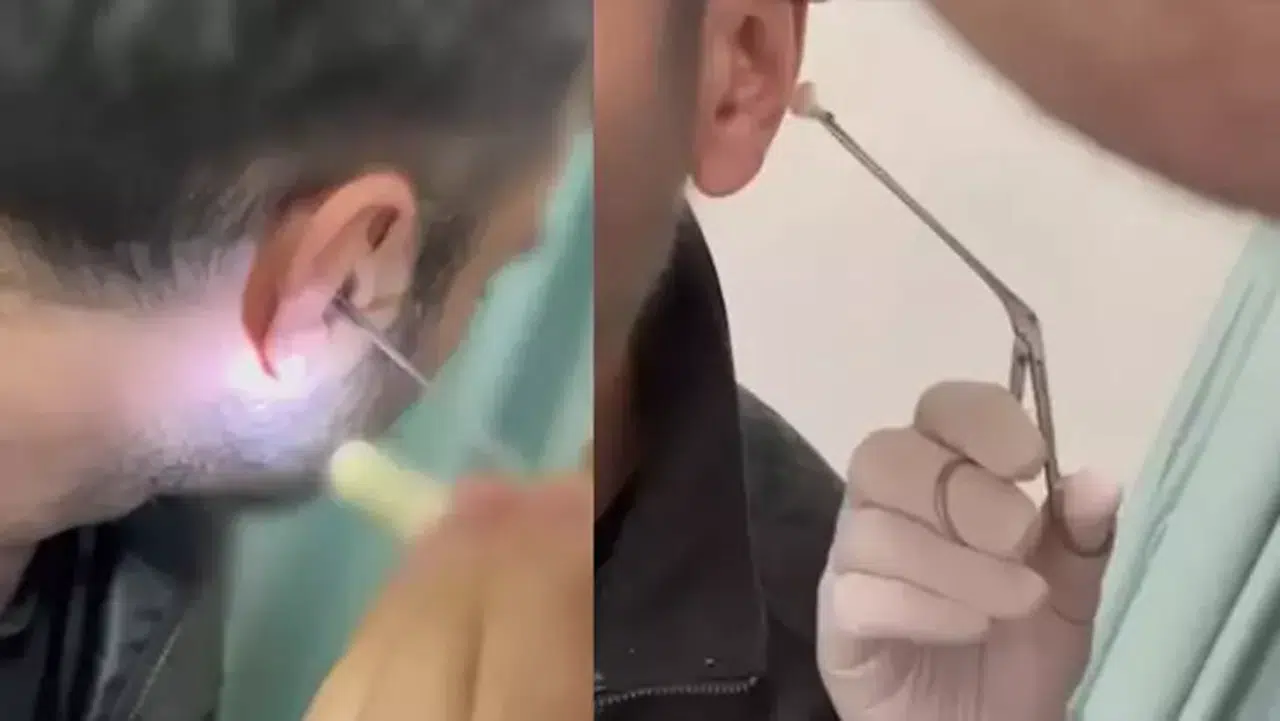 Kayseri’de uyuşturucu operasyonu: Kulağına gizlediği uyuşturucuyla yakalandı